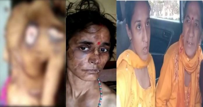 Sister-in-law and mother-in-law harassed Preeti in Vikasnagar