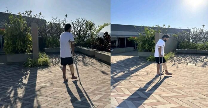 Rishabh Pant was seen standing on his feet after the accident. improvement in health Rishabh Pant was seen standing on his feet after the accident. improvement in health